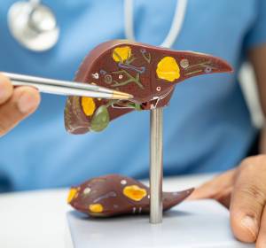 gall stones